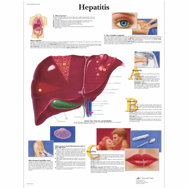 AK VR1435  HEPATITIS