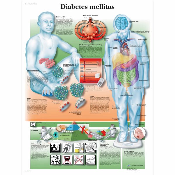 AK VR1441  DIABETES