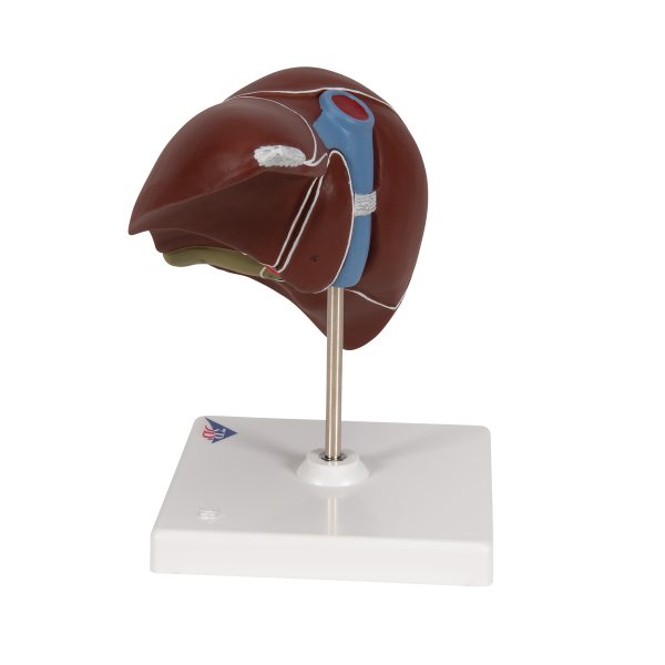 K25 - Model JETRE SA ŽUČNOM KESOM - Image 5