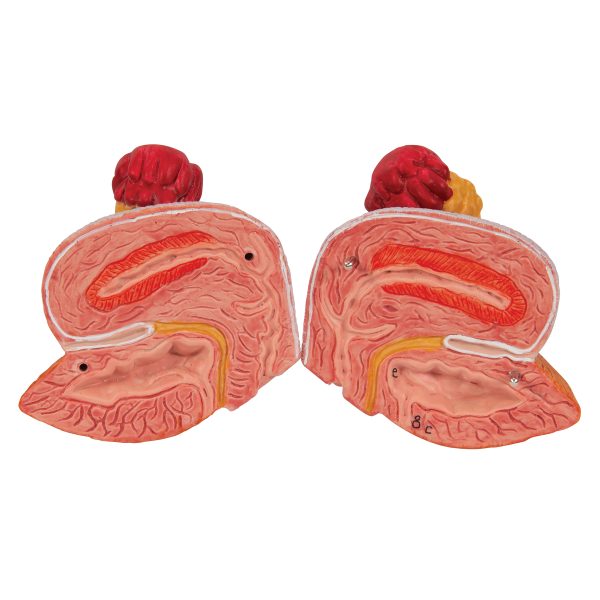 K32 - Model URINARNOG SISTEMA unisex, 6 delova - Image 6