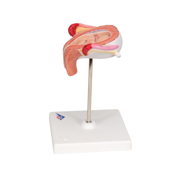 L10/3 - Model  FETUS 3. MESEC - Image 5